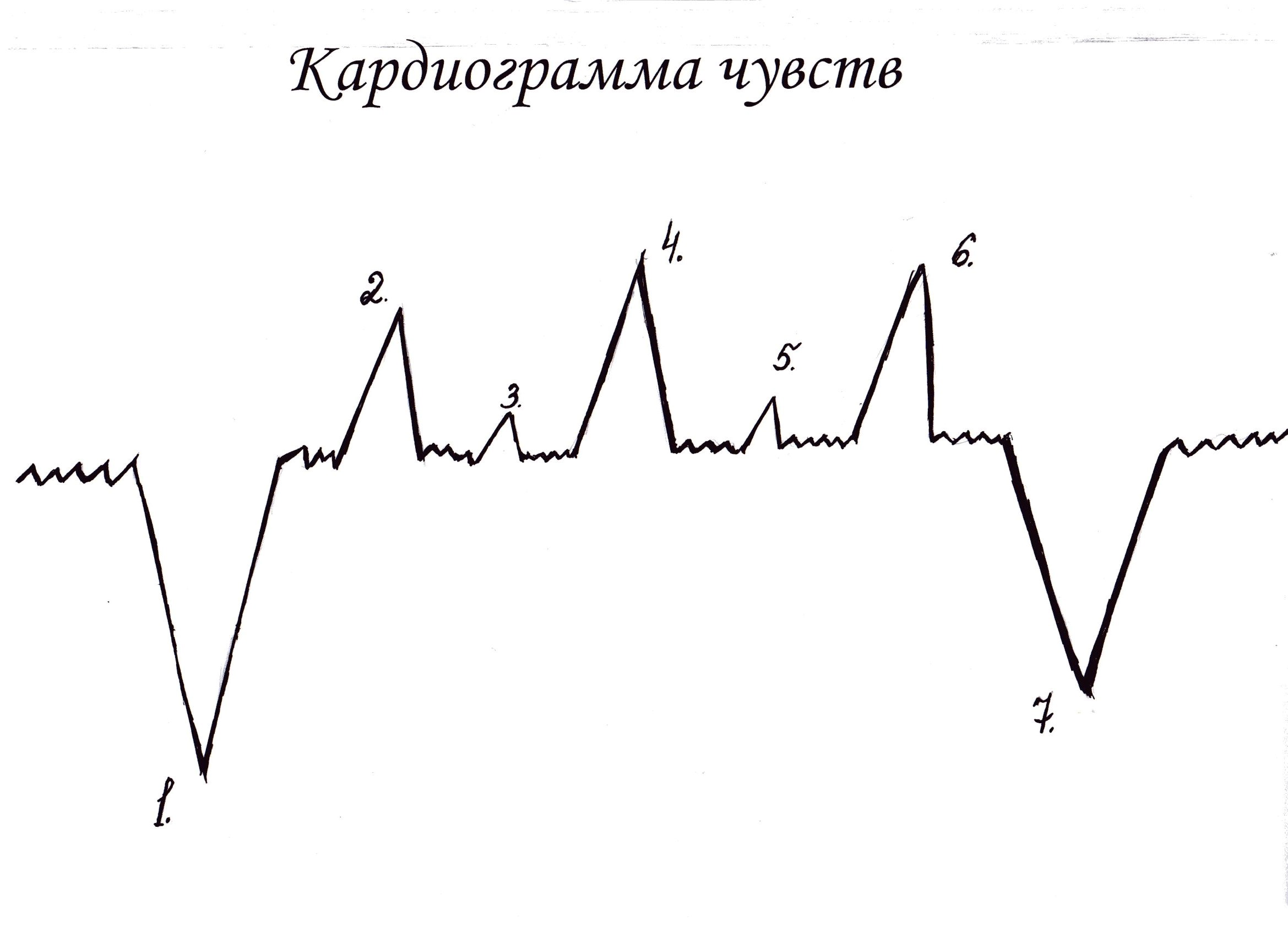 Кардиограмма